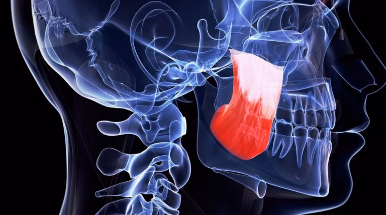 Anévrisme de l&rsquo;aorte abdominale : symptômes et diagnostic précoce